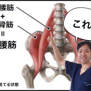 ◤ 両親を寝たきりにさせない方法 ◢ その②-1イメージ